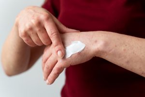 Tallow for Eczema & Psoriasis Natural Relief for Irritated Skin
